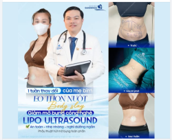 1 TUẦN THAY ĐỔI CỦA MẸ BỈM