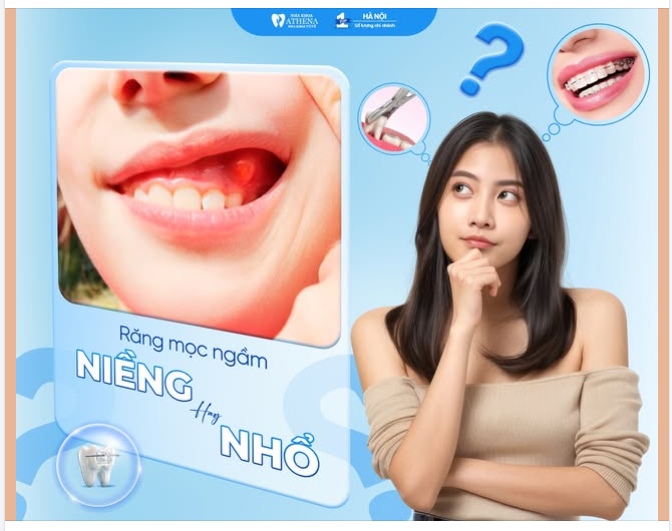 RĂNG MỌC NGẦM – NÊN NIỀNG KÉO LÊN HAY NHỔ BỎ?