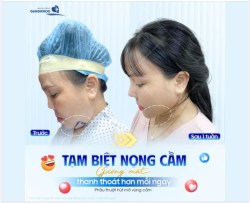 TẠM BIỆT NỌNG CẰM – GƯƠNG MẶT THANH THOÁT HƠN MỖI NGÀY