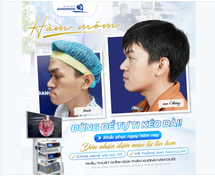 HÀM MÓM – ĐỪNG ĐỂ TỰ TI KÉO DÀI