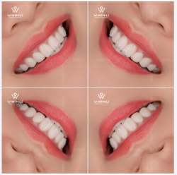 NỤ CƯỜI RẠNG RỠ, TÔN VINH NÉT RIÊNG