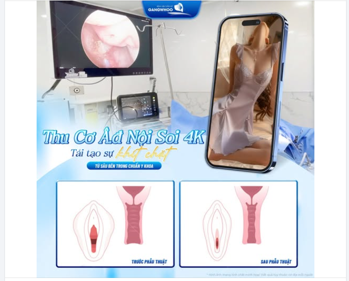 THU CƠ ÂM ĐẠO NỘI SOI 4K - KHÍT CHẶT CHUẨN Y KHOA - THĂNG HOA CẢM XÚC