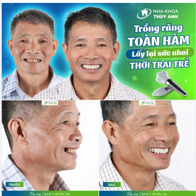 MÓN NGON KHÔNG ĐỂ CHA CHẦN CHỪ GẮP,CHỈ VÌ RĂNG HỎNG…