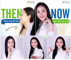 ''CHỤP ẢNH GÓC NGHIÊNG TỪNG LÀ NỖI SỢ CỦA EM…''