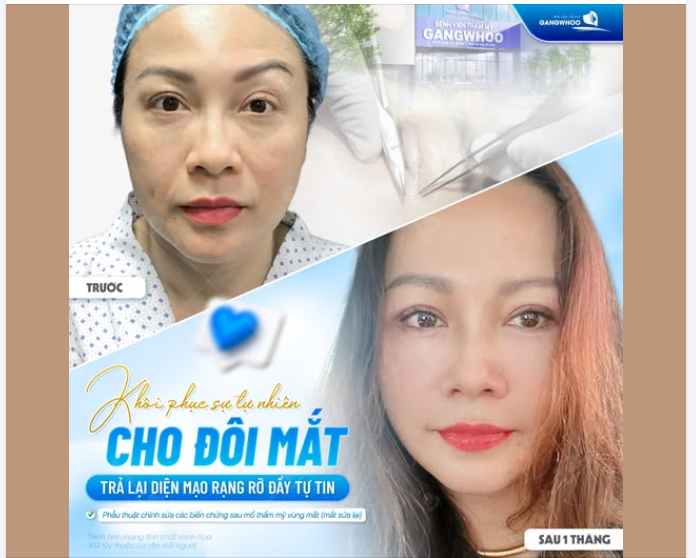 KHÔI PHỤC SỰ TỰ NHIÊN CHO ĐÔI MẮT