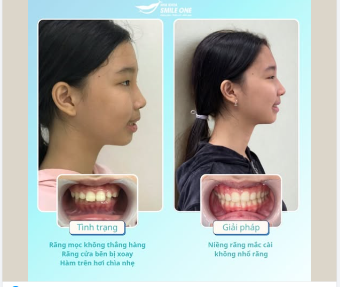 ĐỪNG ĐỂ CON "GIẤU" NỤ CƯỜI SAU TAY ÁO...