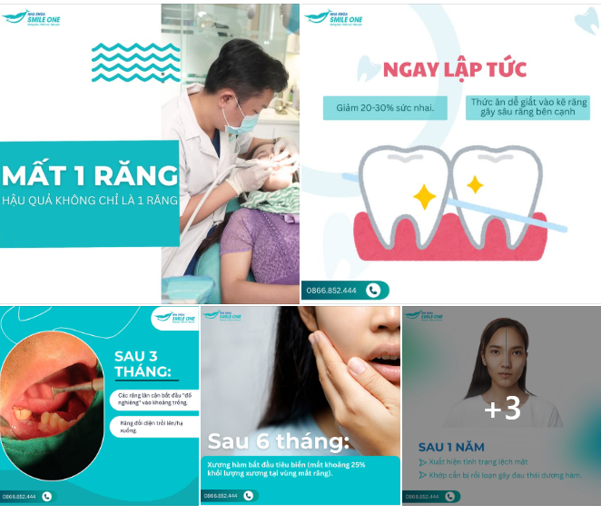 MẤT 1 RĂNG – "KHOẢNG TRỐNG" C.H.Ế.T NGƯỜI BẠN KHÔNG ĐƯỢC PHÉP THỜ Ơ!