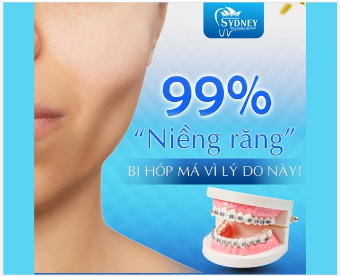 99% NGƯỜI NIỀNG RĂNG BỊ HÓP MÁ VÌ LÝ DO NÀY!