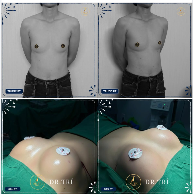 TẠM BIỆT "MÀN HÌNH PHẲNG" - CHÀO ĐÓN ĐƯỜNG CONG QUYẾN RŨ