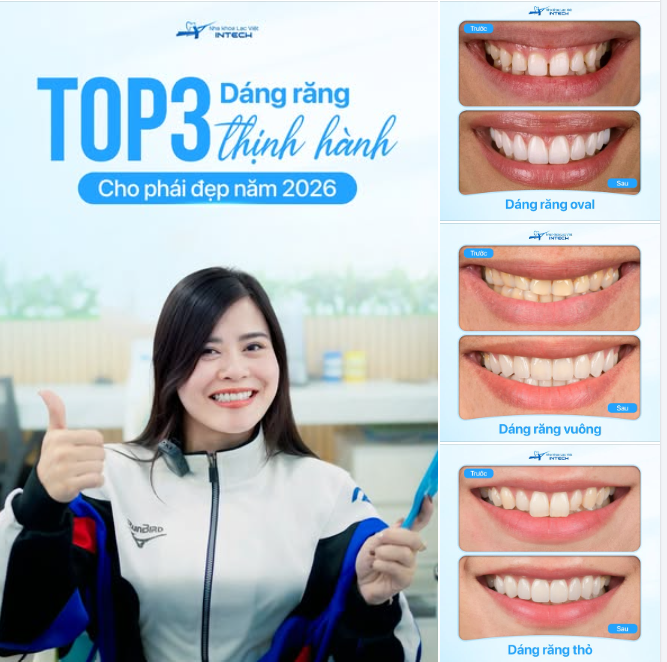 TOP 3 DÁNG RĂNG THỊNH HÀNH CHO PHÁI ĐẸP NĂM 2026