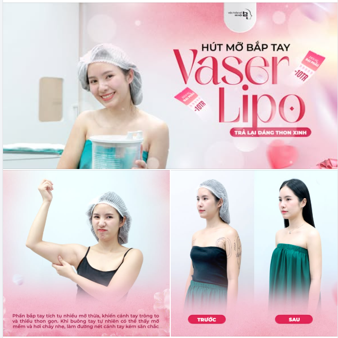 BẮP TAY TO – MẶC GÌ CŨNG KÉM XINH?