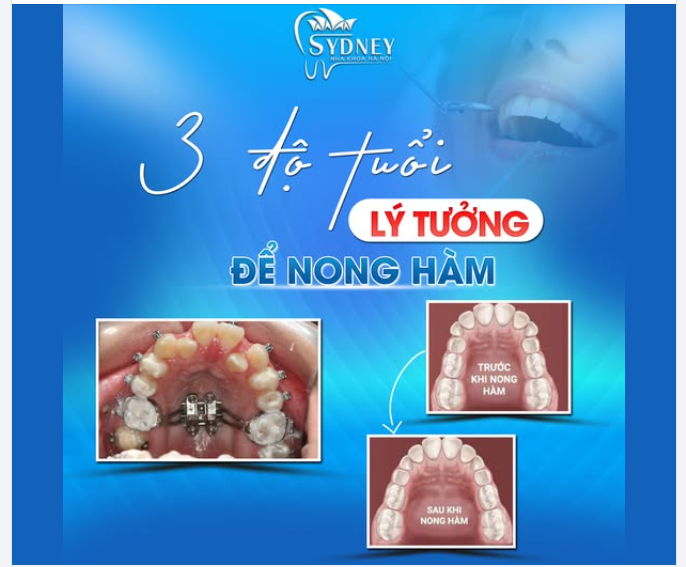 ĐỘ TUỔI LÝ TƯỞNG ĐỂ NONG HÀM