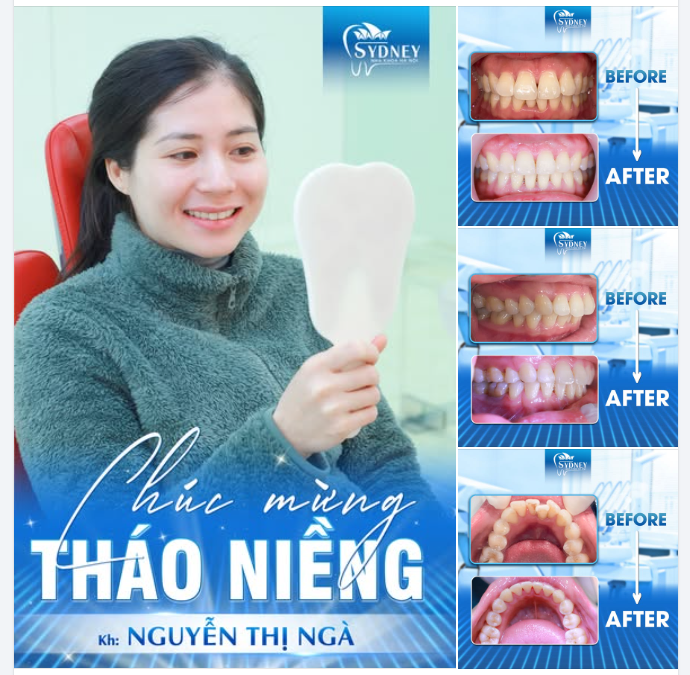 CHÚC MỪNG THÁO NIỀNG KH. NGUYỄN NGÀ