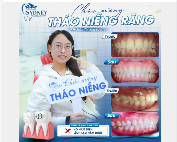 CHÚC MỪNG THÁO NIỀNG KH. KIM LOAN