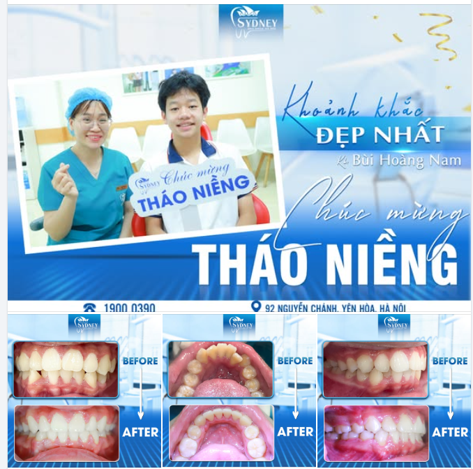KHOẢNH KHẮC ĐẸP NHẤT HÔM NAY: KH.HOÀNG NAM CHÍNH THỨC THÁO NIỀNG