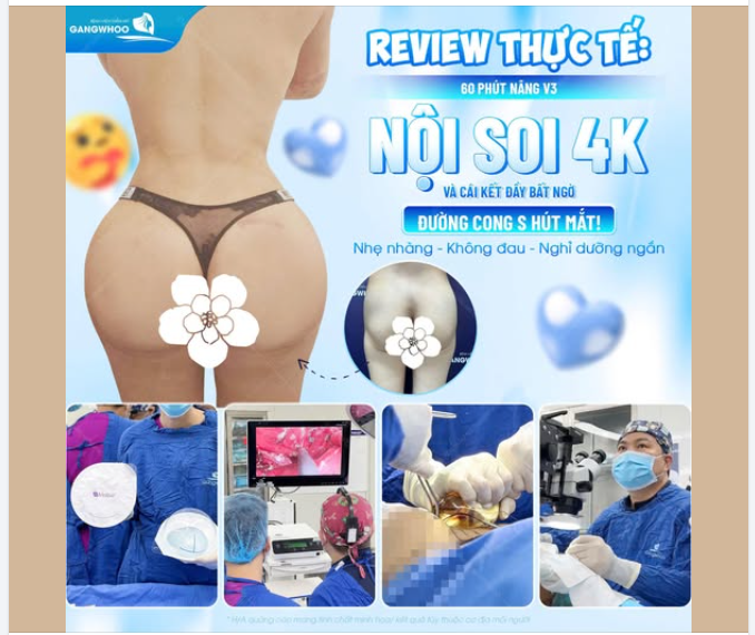 REVIEW THỰC TẾ: 60 PHÚT NÂNG V3 NỘI SOI 4K VÀ CÁI KẾT ĐẦY BẤT NGỜ!