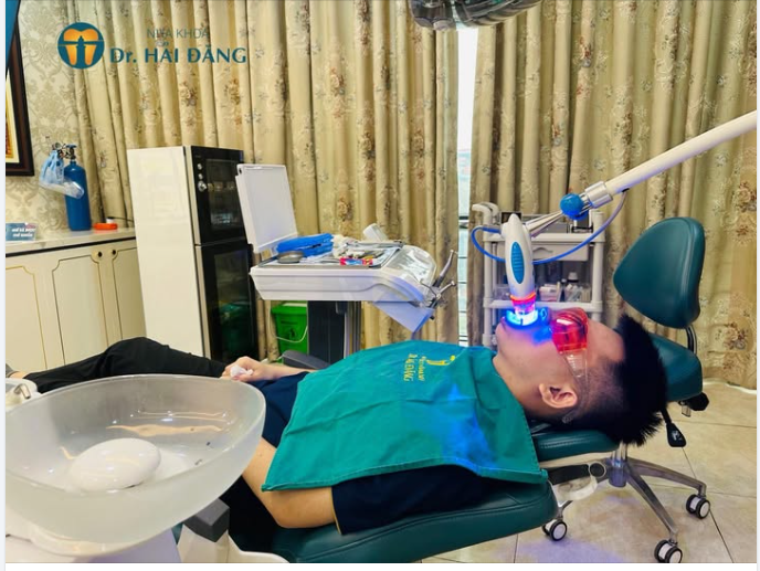 RĂNG Ố VÀNG – XỈN MÀU CHỈ 1 GIỜ LÀ BẬT TONE TRẮNG SÁNG