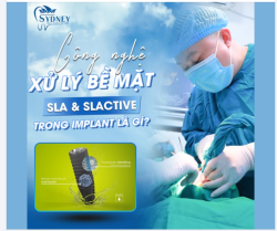 CÔNG NGHỆ XỬ LÝ BỀ MẶT SLA SLACTIVE TRONG IMPLANT LÀ GÌ?