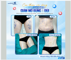 CẢI THIỆN VÓC DÁNG NHẸ NHÀNG – TÌM LẠI SỰ TỰ TIN