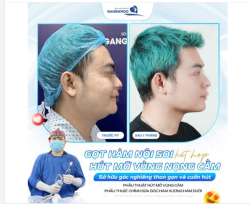 GỌT HÀM NỘI SOI HÚT MỠ NỌNG CẰM