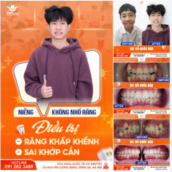 CUỘC "DẬY THÌ THÀNH CÔNG" CỦA BẠN ĐỖ QUỐC BẢO!