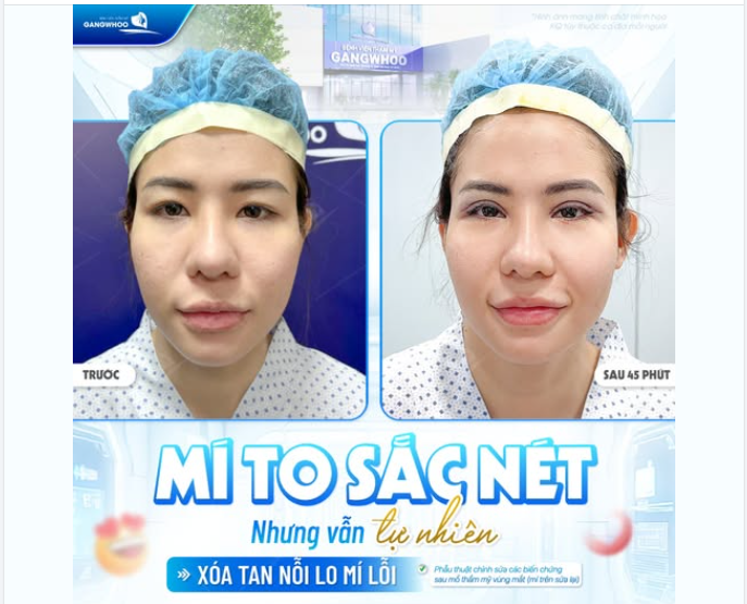 MÍ TO SẮC NÉT, NHƯNG VẪN TỰ NHIÊN