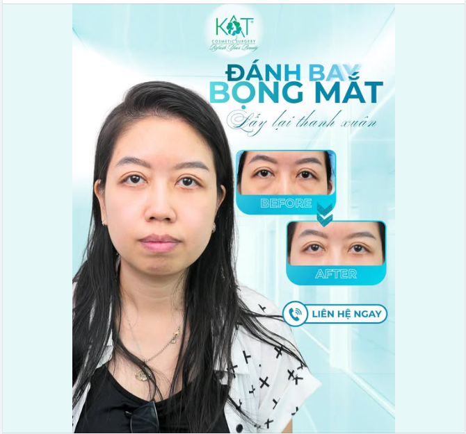 “Chỉ mới U30–U40… nhưng mắt đã bắt đầu già đi.”