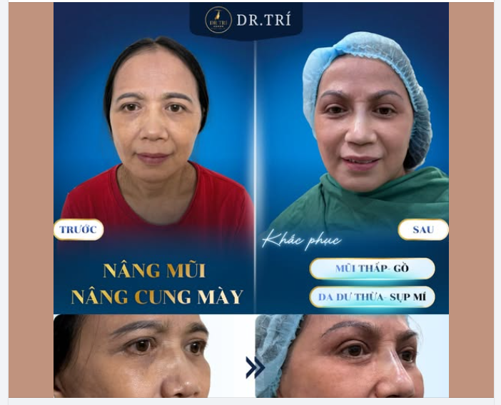 ĐẸP TỰ NHIÊN - AN TOÀN TUYỆT ĐỐI CÙNG DR.TRÍ