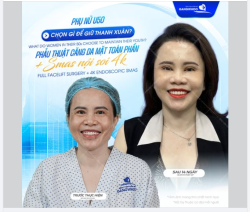 Chị L - hạnh phúc chia sẻ sau khi thực hiện thành công phẫu thuật căng da mặt toàn phần + Smas nội soi 4K.