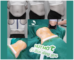 Bụng to, thừa mỡ cỡ nào - 60P giải quyết triệt để