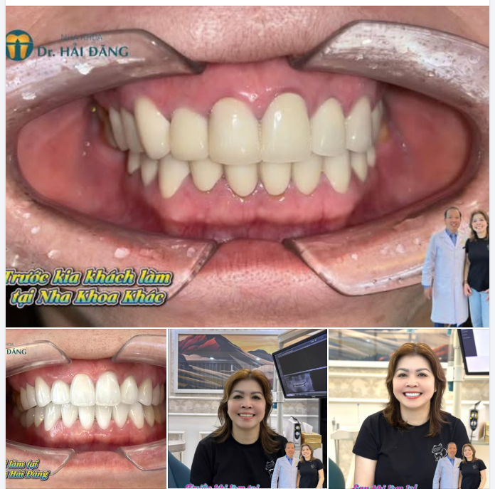 LÀM RĂNG SAI NƠI – HỆ QUẢ KHÔNG NHỎ