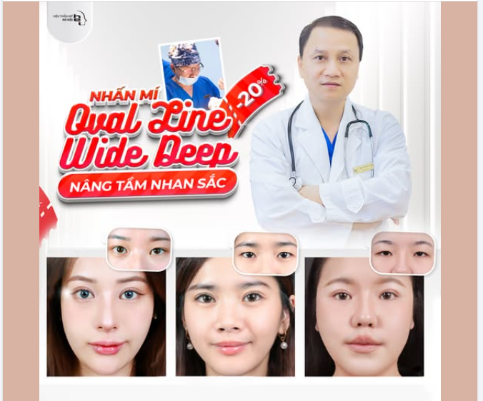 NHẤN MÍ OVAL LINE WIDE DEEP