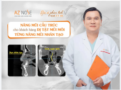 Tư vấn nâng mũi cấu trúc cho khách hàng dị tật mũi môi từng nâng mũi nhân tạo.