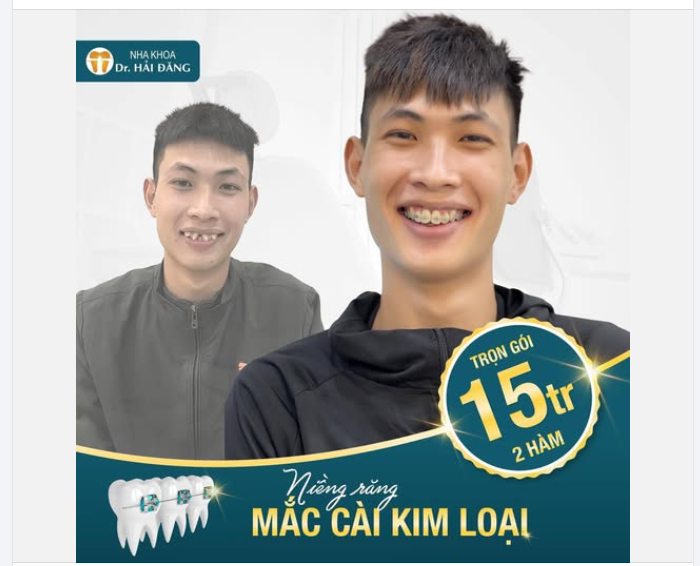 LỘT XÁC NỤ CƯỜI – TỰ TIN HƠN MỖI NGÀY