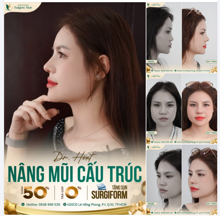 DÁNG MŨI QUYẾT ĐỊNH 70% THẦN THÁI VÀ SỰ TỰ TIN!!!