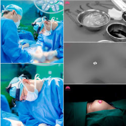 CẢNH BÁO: NÂNG NGỰC LÂU NĂM hay TIÊM CHẤT LÀM ĐẦY KHÔNG RÕ NGUỒN GỐC - NGUY CƠ BIẾN CHỨNG KHÓ LƯỜNG