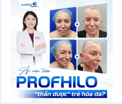 AI NÊN TIÊM PROFHILO – “THẦN DƯỢC” TRẺ HÓA DA?