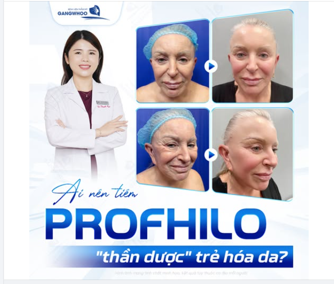 AI NÊN TIÊM PROFHILO – “THẦN DƯỢC” TRẺ HÓA DA?