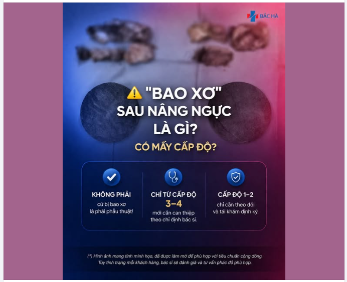 NGHE “BAO XƠ” LÀ NGHĨ PHẢI MỔ LẠI? SAI RỒI!