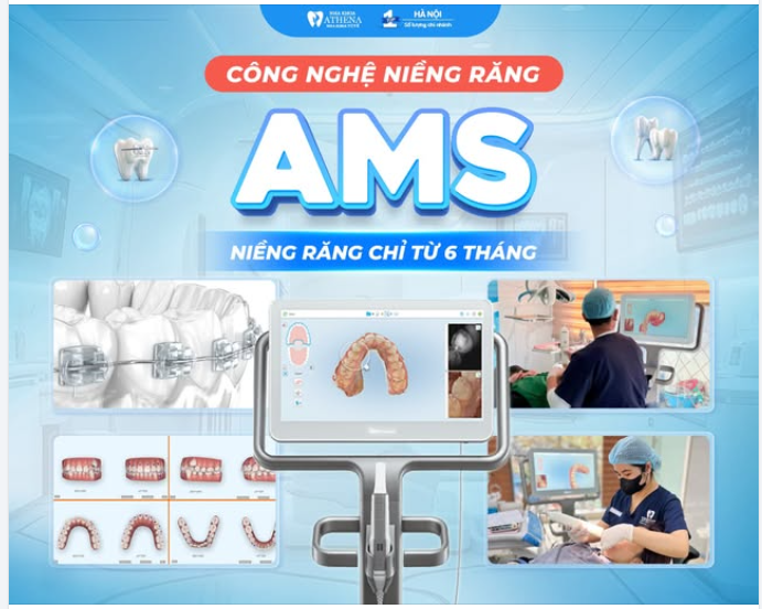 Bạn muốn niềng răng nhưng sợ phải đeo mắc cài 2-3 năm đằng đẵng?