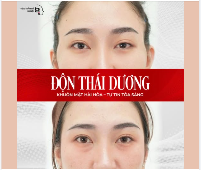 ĐỘN THÁI DƯƠNG - GƯƠNG MẶT THANH TÚ