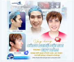 ỨNG DỤNG CÔNG NGHỆ NỘI SOI TRONG GỌT HÀM