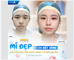 MÍ ĐẸP NÉT XINH – DIỆN MẠO BẬT SÁNG