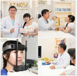 Tự ti vì bị dị t.ật mũi môi từ nhỏ, chị T.V. đã trải qua 2 lần chỉnh môi, niềng răng và nâng mũi nhân tạo. Tuy nhiên, gương mặt hiện tại vẫn chưa hài hoà như chị mong muốn.
