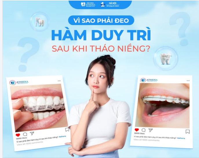 THÁO NIỀNG RỒI, CÓ CẦN ĐEO HÀM DUY TRÌ KHÔNG? NÊN CHỌN LOẠI NÀO TỐT NHẤT?