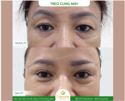 Sở hữu đôi mắt tinh anh và cung mày thanh tú là mong muốn của bất kỳ ai khi bước vào độ tuổi lão hóa.