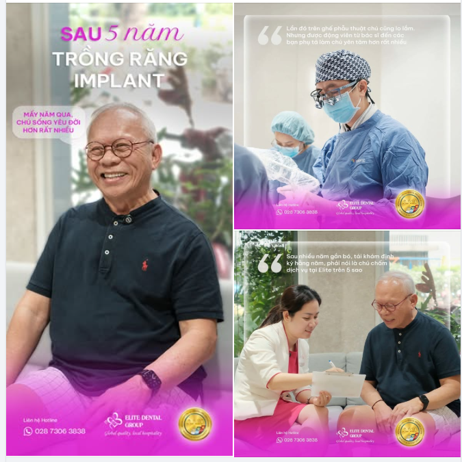 KẾT QUẢ TRỒNG RĂNG IMPLANT SAU 5 NĂM