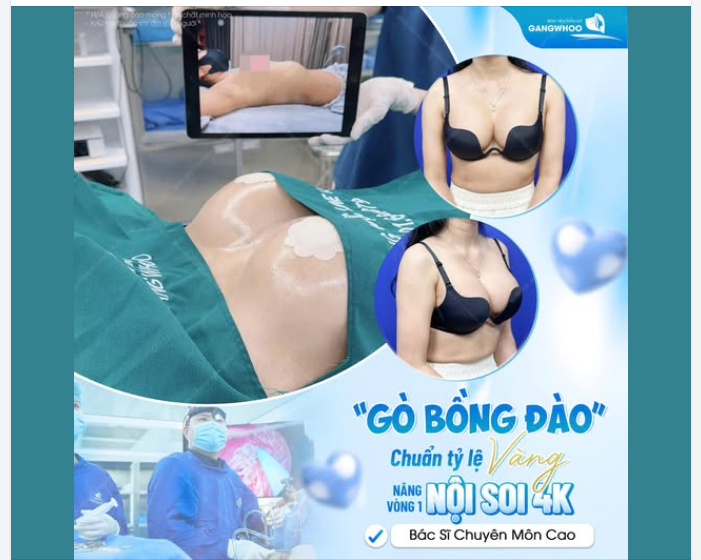 ĐÔI GÒ BỒNG ĐÀO HOÀN HẢO CHỈ SAU 60 PHÚT NÂNG CẤP