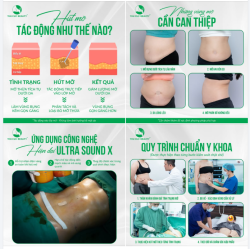 Hút mỡ công nghệ Ultra Sound X - Tác động chọn lọc vùng mỡ thừa