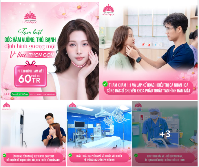 TẠM BIỆT GÓC HÀM VUÔNG/THÔ/BẠNH - KIẾN TẠO GƯƠNG MẶT V-LINE THON GỌN